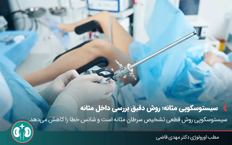 bladder cancer diagnosis ultrasound vs cystoscopy 02