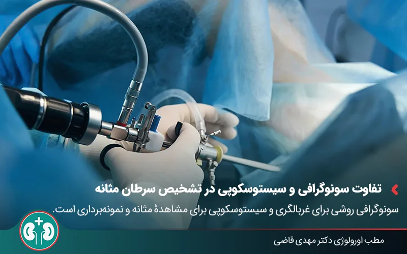 bladder cancer diagnosis ultrasound vs cystoscopy 03