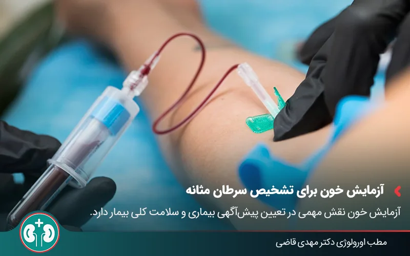 bladder cancer diagnosis ultrasound vs cystoscopy 04