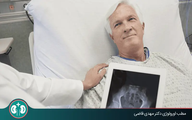 bladder cancer survival rate