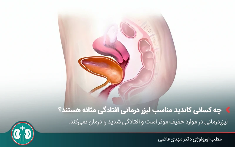 bladder prolapse laser therapy 03