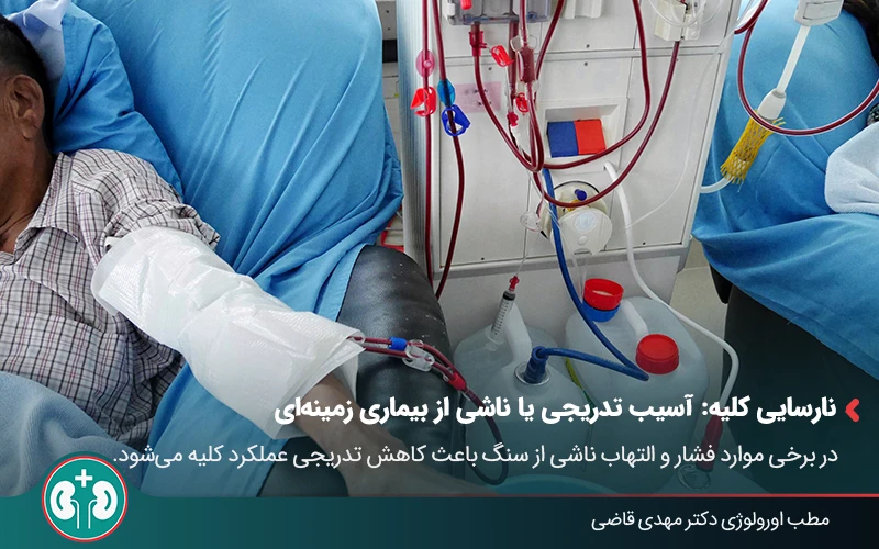 kidney stone complications 01