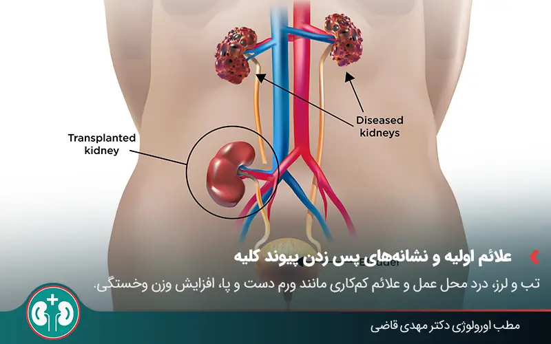 kidney transplant rejection symptoms 01