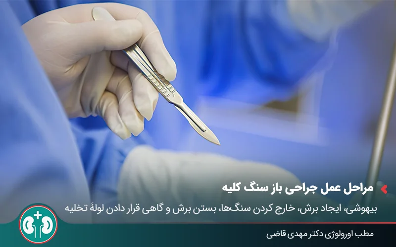 open kidney stone surgery 02