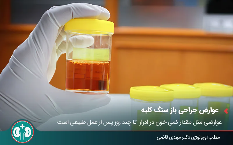 open kidney stone surgery 04