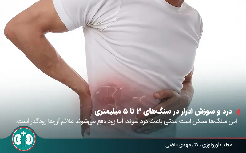 passing 4 10mm kidney stones 01