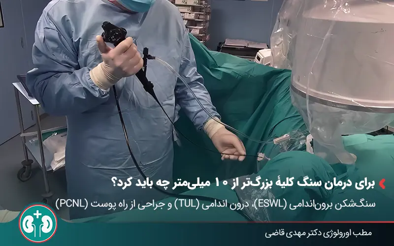 passing 4 10mm kidney stones 04