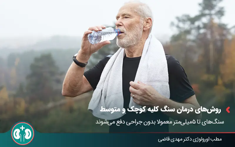 passing 4 10mm kidney stones3