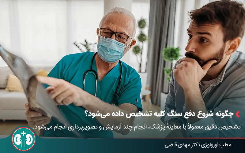 passing kidney stone symptoms 05