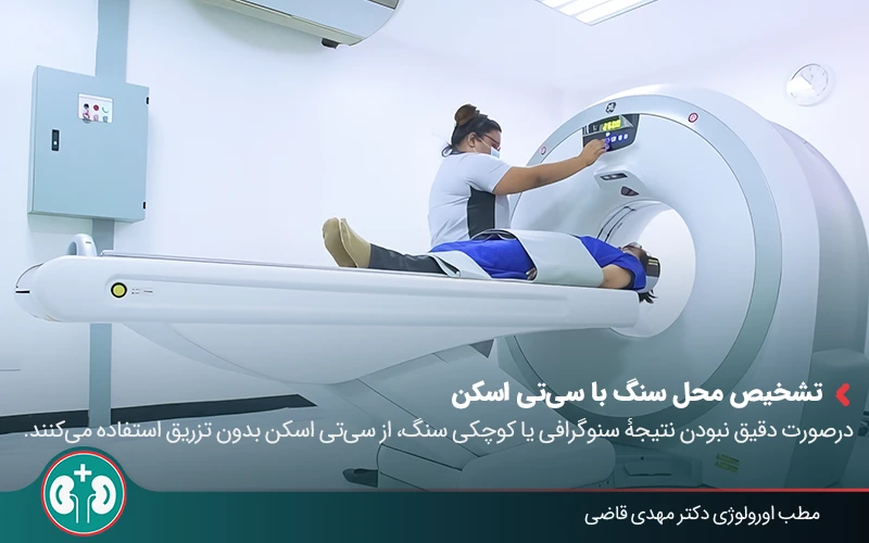 passing kidney stone symptoms 06