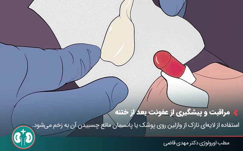 post circumcision infection 04