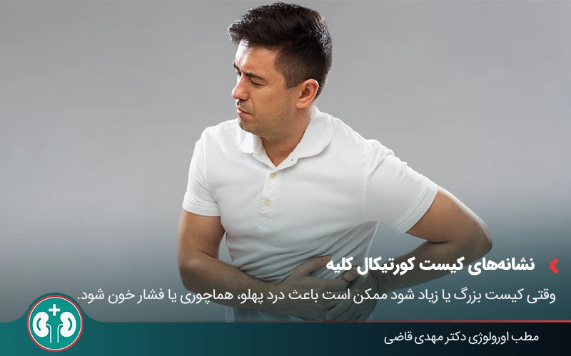 renal cortical cyst 02