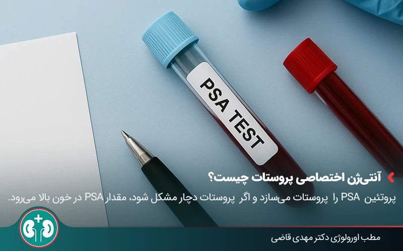 Prostate cancer screening 02