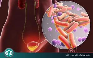 تصویر شماتیک دستگاه ادراری که التهاب مثانه و باکتری‌های عامل عفونت مثانه را نشان می‌دهد.