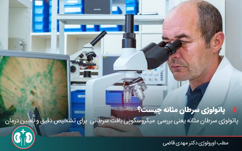 bladder cancer pathology 01