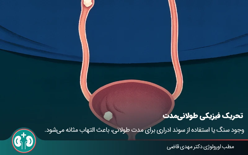 cystits treatment 03