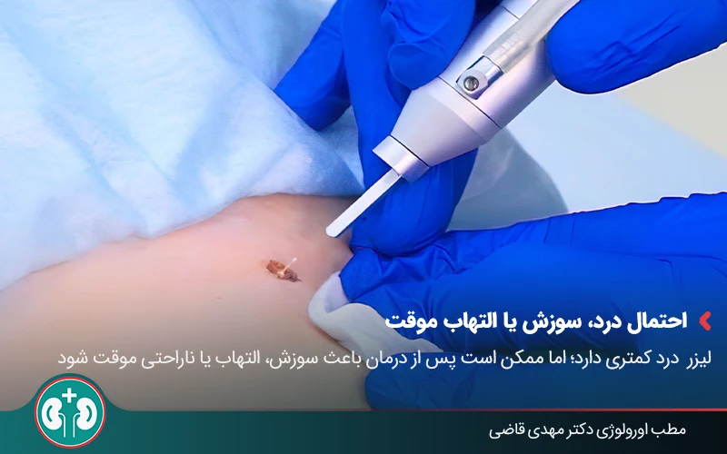 genital warts laser therapy 02
