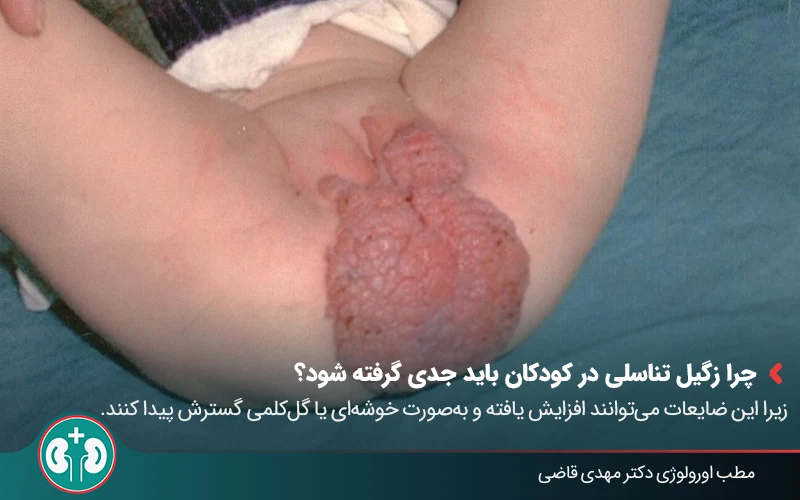 genital warts symptoms in children 01