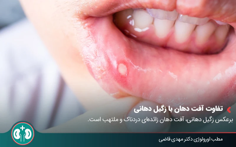 oral genial warts symtoms 02