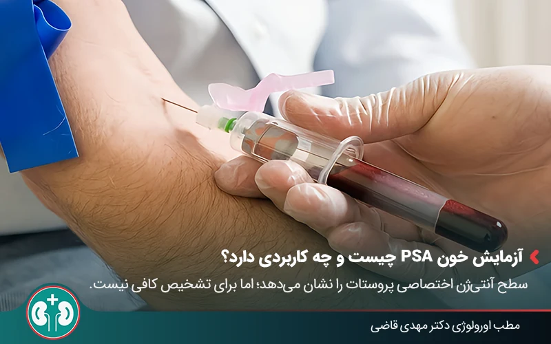 prostate cancer diagnosis 02