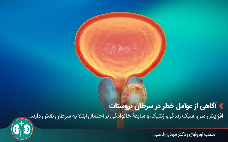 prostate cancer diagnosis 06