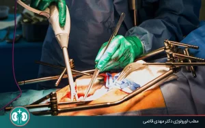 radical cystectomy for bladder cancer