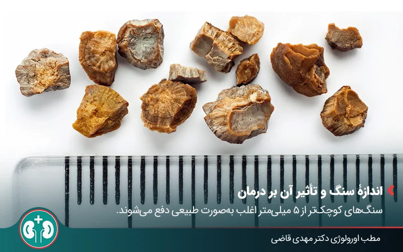 types of kidney stones 05