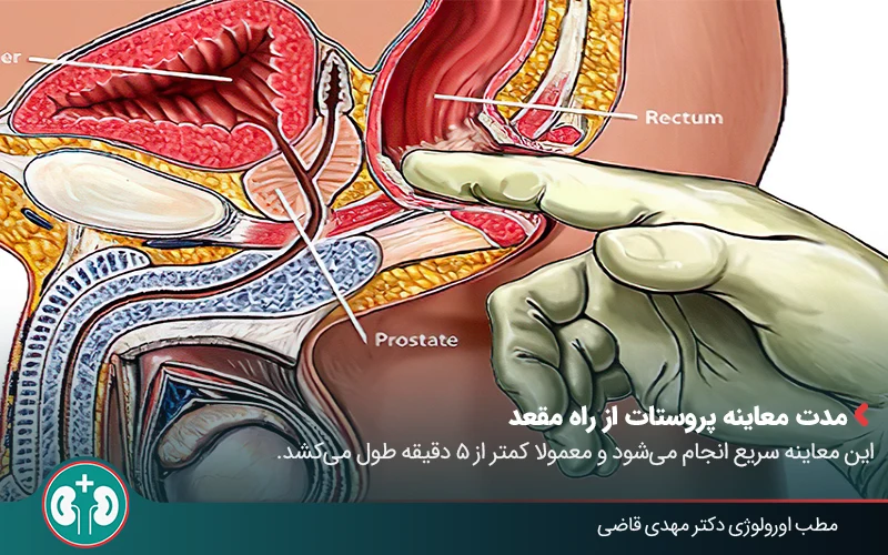 digital rectal examination 04