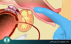 digital rectal examination