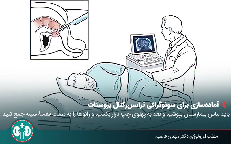 transrectal ultrasound prostate 04