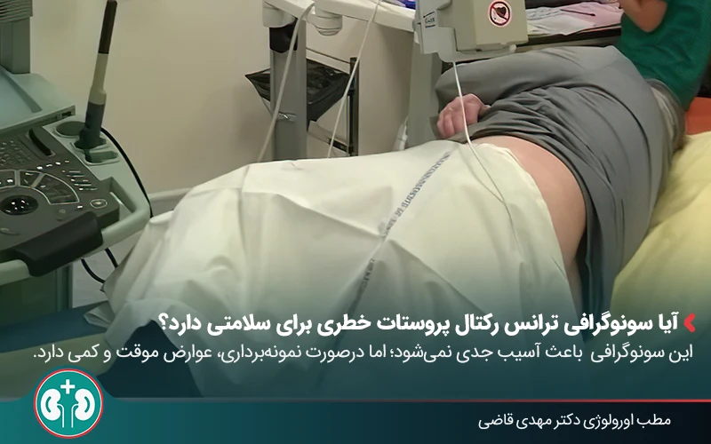 transrectal ultrasound prostate 05