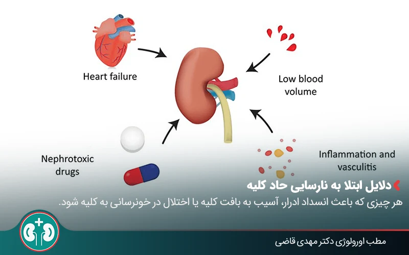 Acute Kidney Injury 03