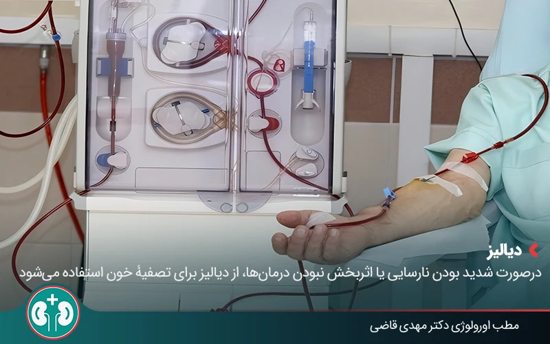 Acute Kidney Injury 05