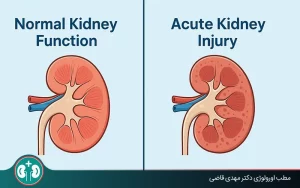 Acute Kidney Injury