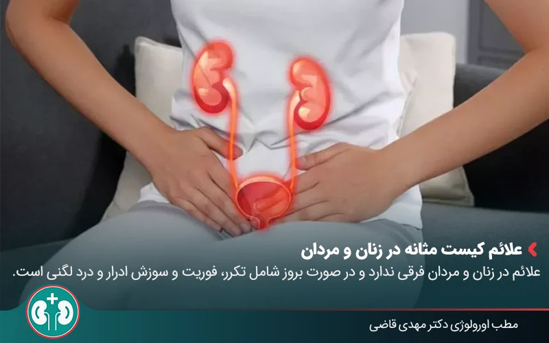 bladder cyst 01