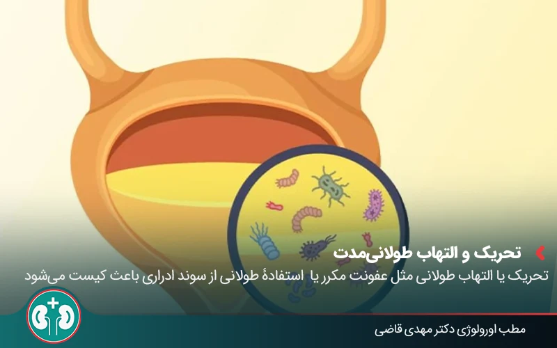 bladder cyst 02