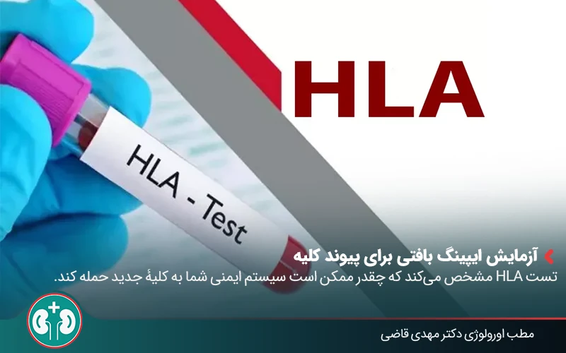 evaluation kidney transplant 04