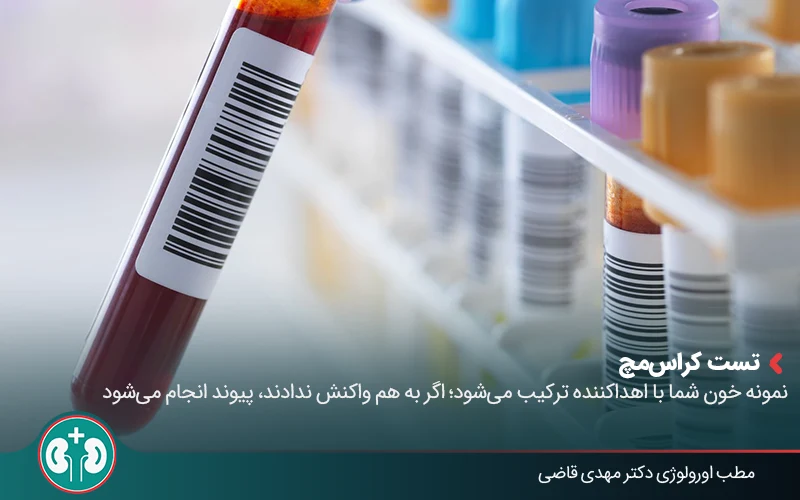 evaluation kidney transplant 05