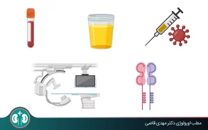 evaluation kidney transplant