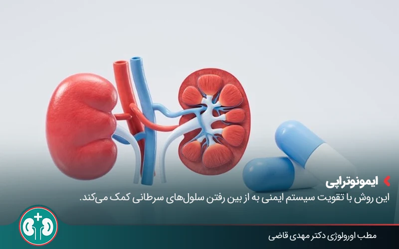 kidney cancer 07