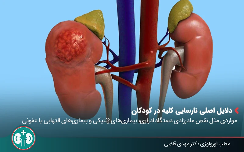 pediatric kidney transplant 01