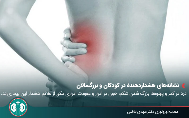 polycystic kidney disease 03