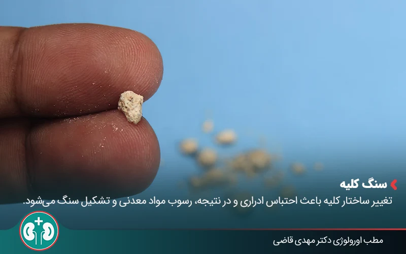 polycystic kidney disease 04