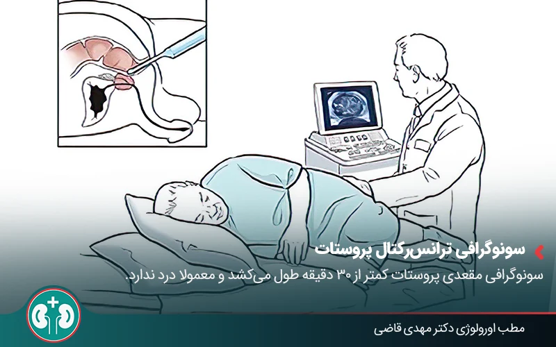 prostate ultrasound 03
