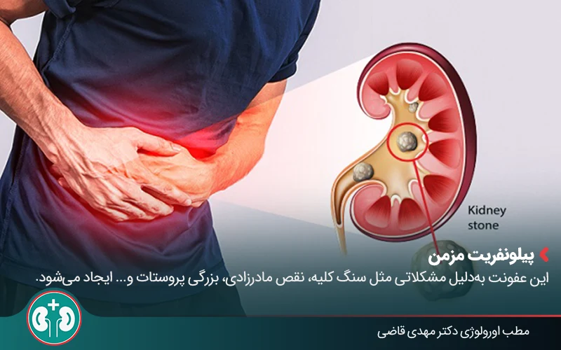 pyelonephritis 1