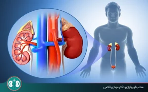 pyelonephritis