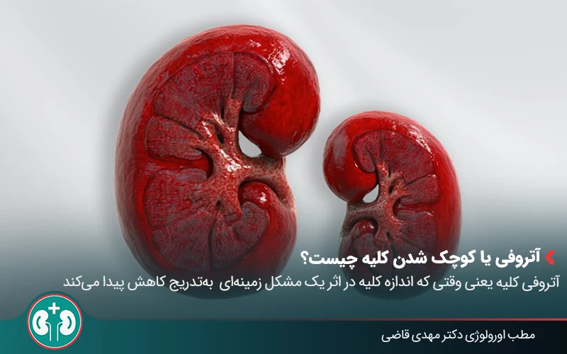 renal atrophy 01