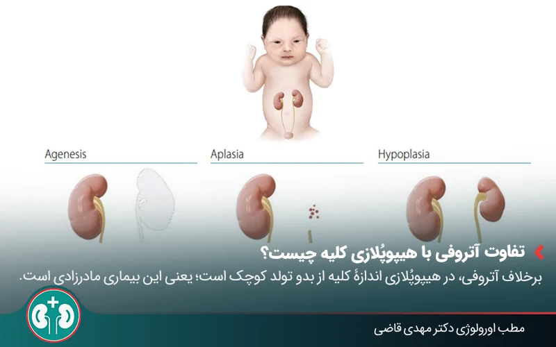 renal atrophy 02