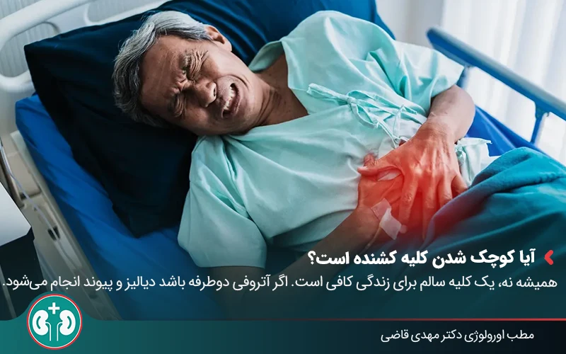 renal atrophy 03