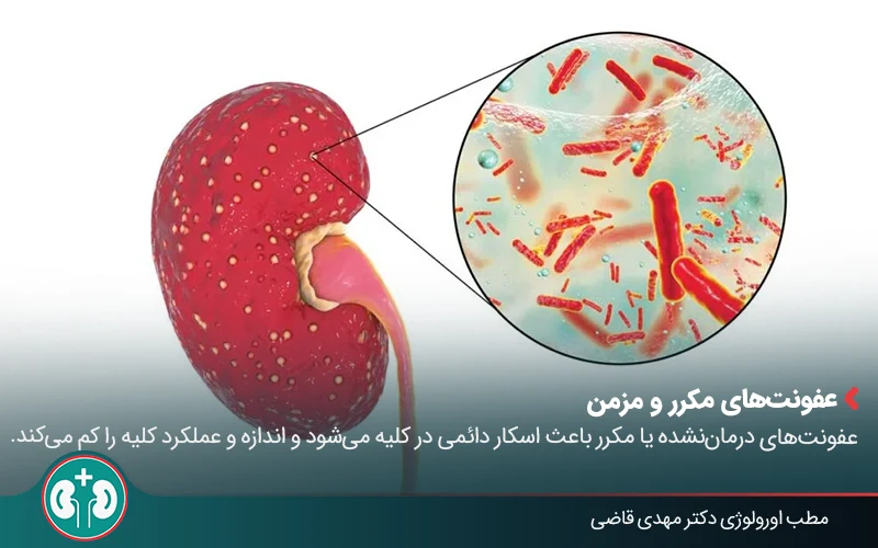 renal atrophy 06